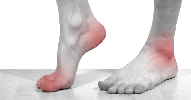 Chiropody foot treatment