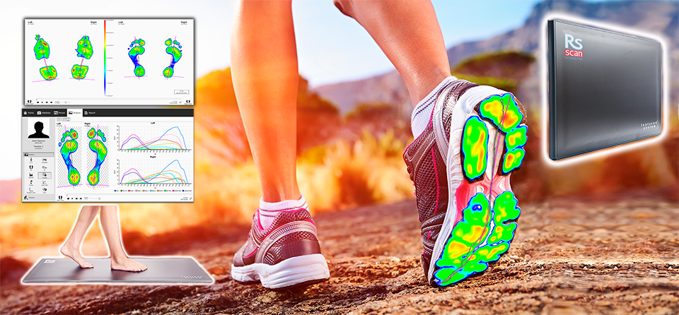 Gait Analysis- chiropody- plantar fasciitis-foot pain